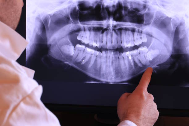 Best Weekend Emergency Dentist in Eldorado, IL