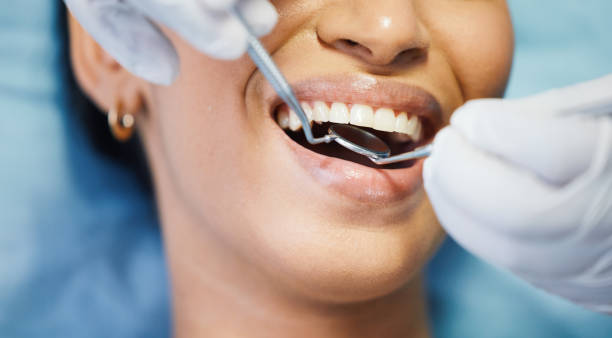 Best Urgent Dental Care for Toothache in Eldorado, IL
