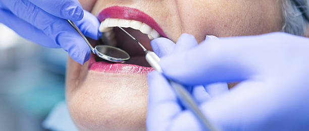 Best Emergency Dental Services for Seniors in Eldorado, IL